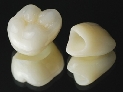 代々木クリスタル歯科医院で保険治療でも「白い歯」に。CAD/CAM冠