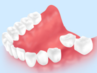 代々木クリスタル歯科医院の自家歯牙移植治療