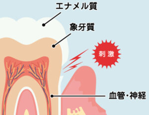 代々木の歯医者、 代々木クリスタル歯科医院で朝起きたときに歯が浮く感じについての解説
