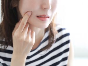 代々木の歯医者、 代々木クリスタル歯科医院で口角炎についての解説